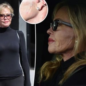 The Price of Perfection: Why Melanie Griffith’s New Face is a Brutal Warning to Every Woman in Hollywood